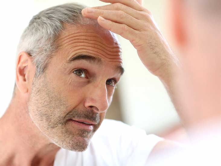 Top 7 Vitamins for Grey Hair Reversal