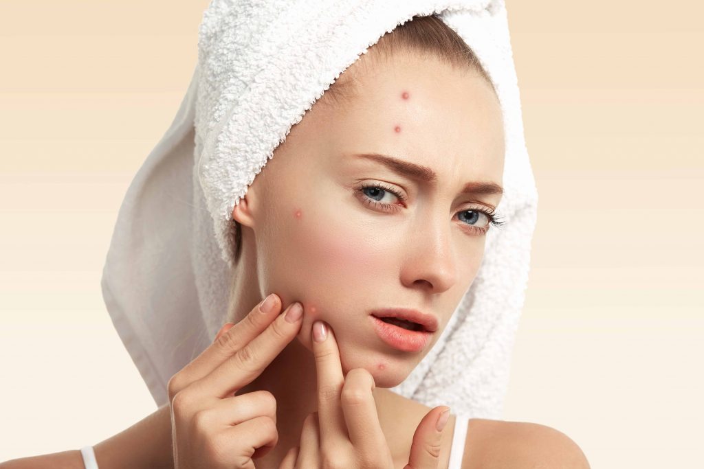 blind-pimples-the-ultimate-in-skincare-nunc
