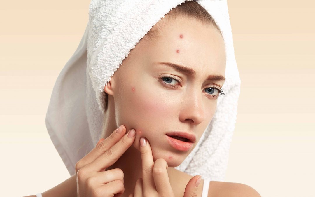 Blind Pimples: The Ultimate in Skincare